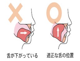 正しい舌の位置